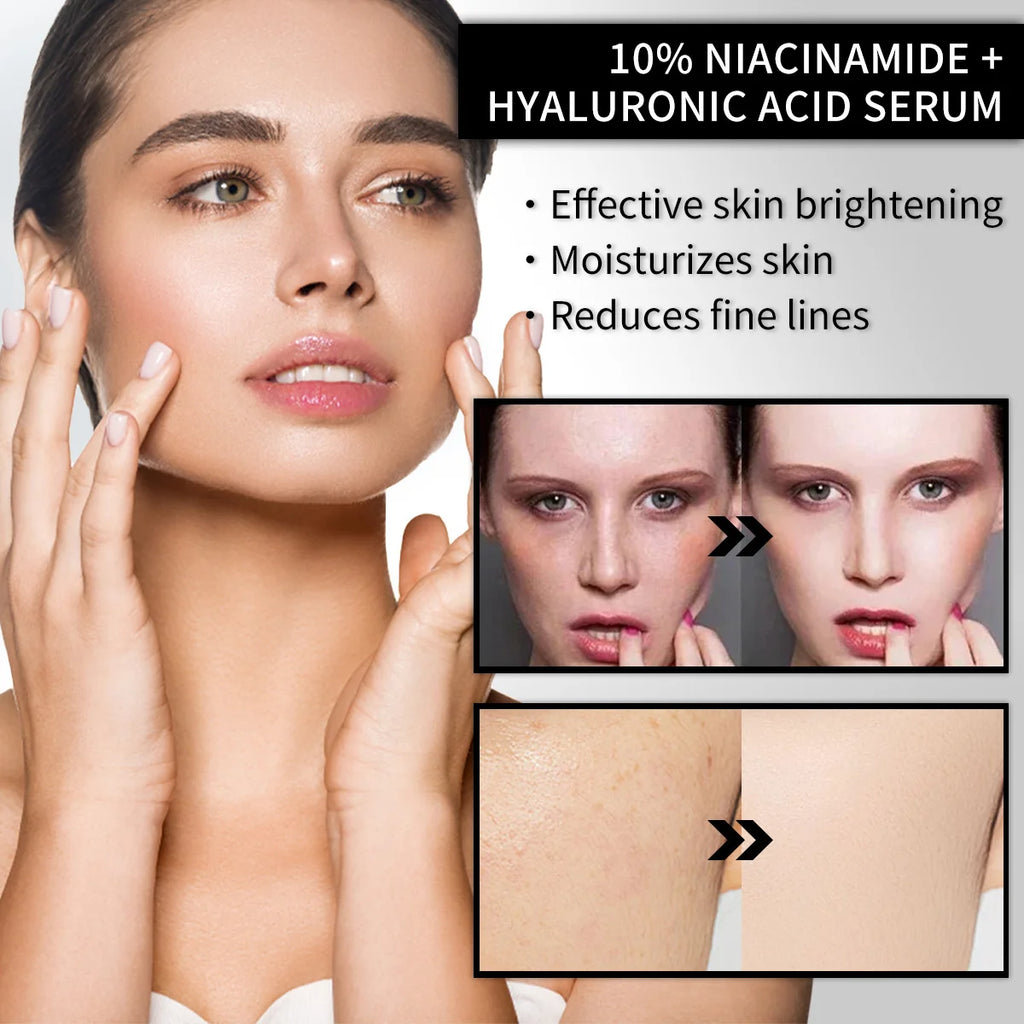 Barubt Pre Makeup Essence Spray | 10% Niacinamide & Hyaluronic Acid | Hydrating Brightening Korean Skincare